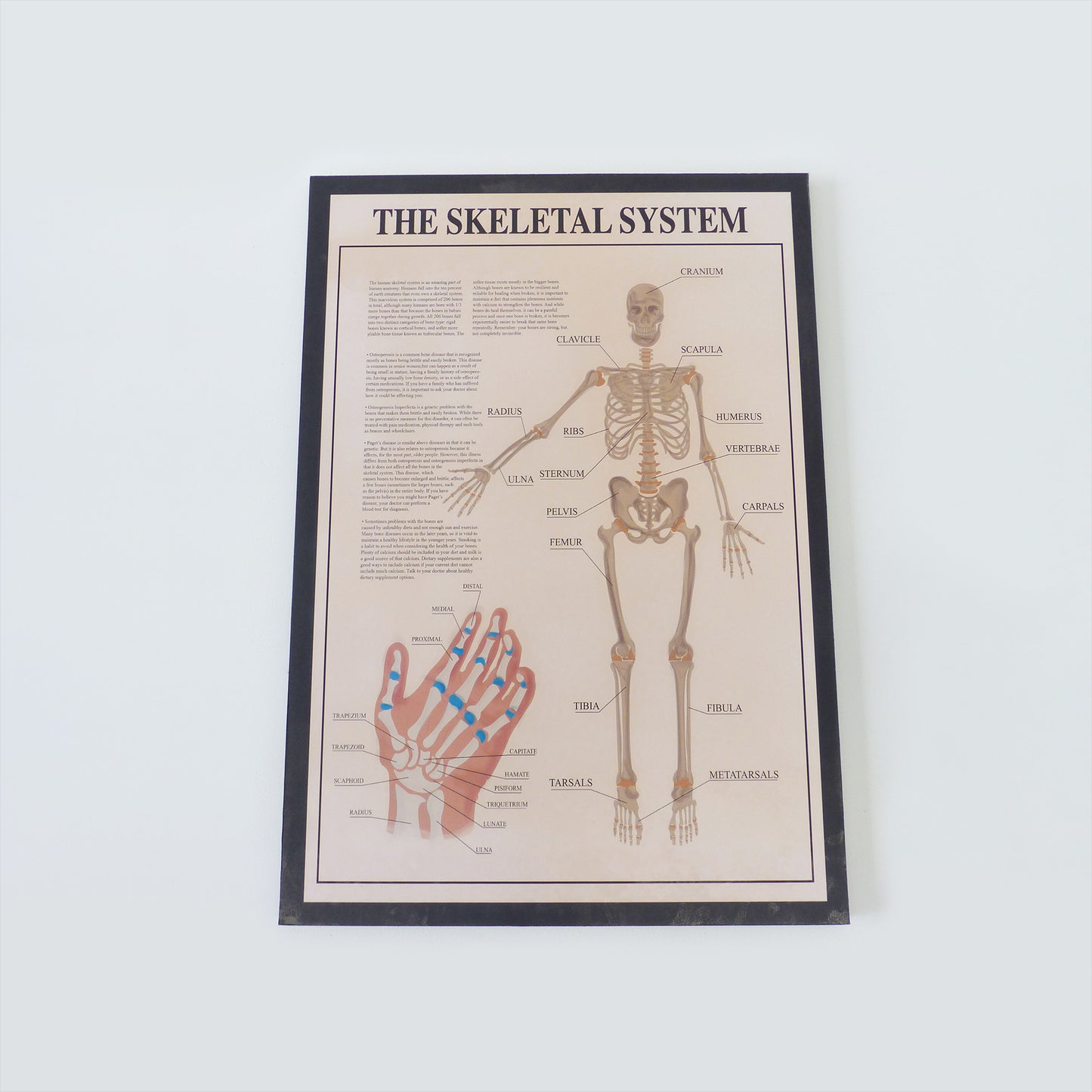 Skeletal System Medical Poster